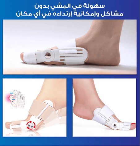 جهاز YC لتقويم اعوجاج اصبع القدم وعلاج الوكعة