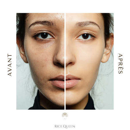 Pack Rice Queen Visage