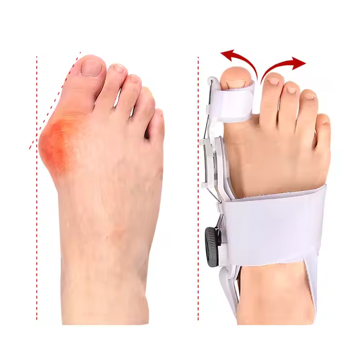 Bunion Corrector