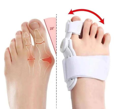 مصحح اعوجاج اصبع القدم