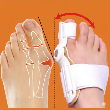 دعامة اعوجاج الاصبع