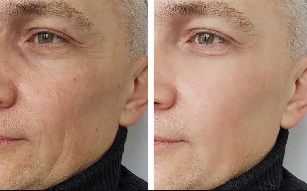 💚  سيروم الريتينول لشد البشرة ومكافحة التجاعيد. 💚