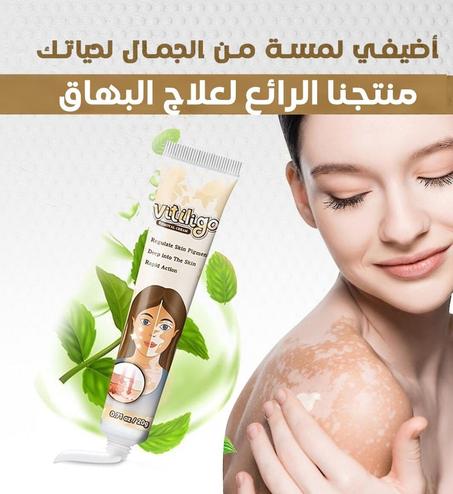 كريم فيتيليغو العشبي لعلاج بهاق الوجه و اليدين و المناطق الحساسة