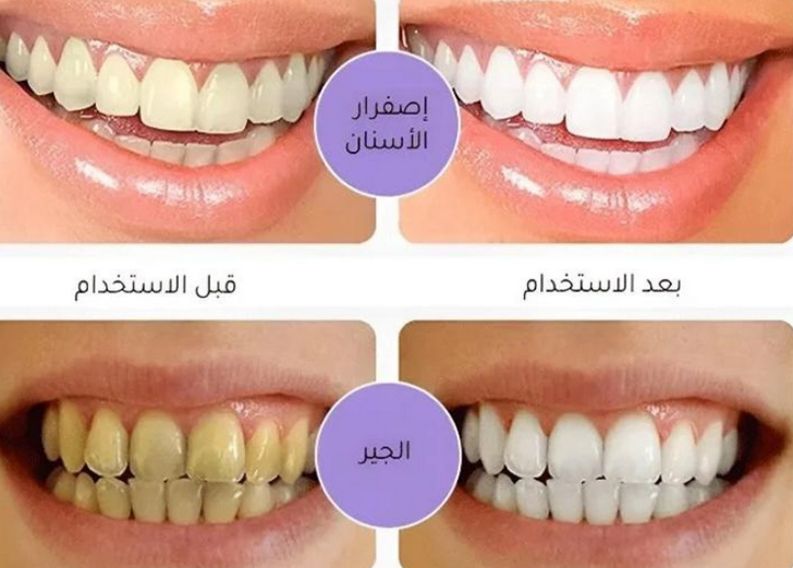 معجون الأسنان الأرجواني * PURPLE TOOTHPASTE