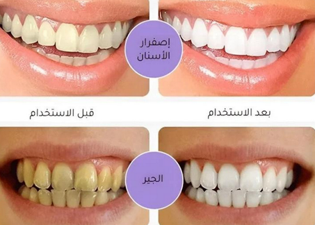 معجون الأسنان الأرجواني