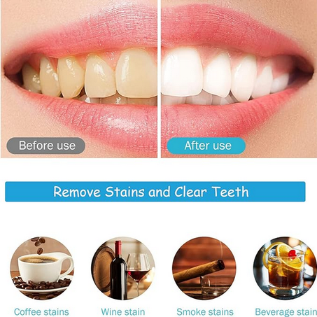 Teeth Whitening Strips/شرائط تبييض الأسنان