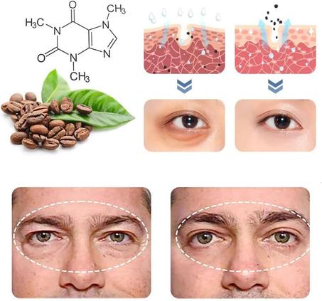 Eye Cream Anti Aging/كريم العين لإزالة التجاعيد