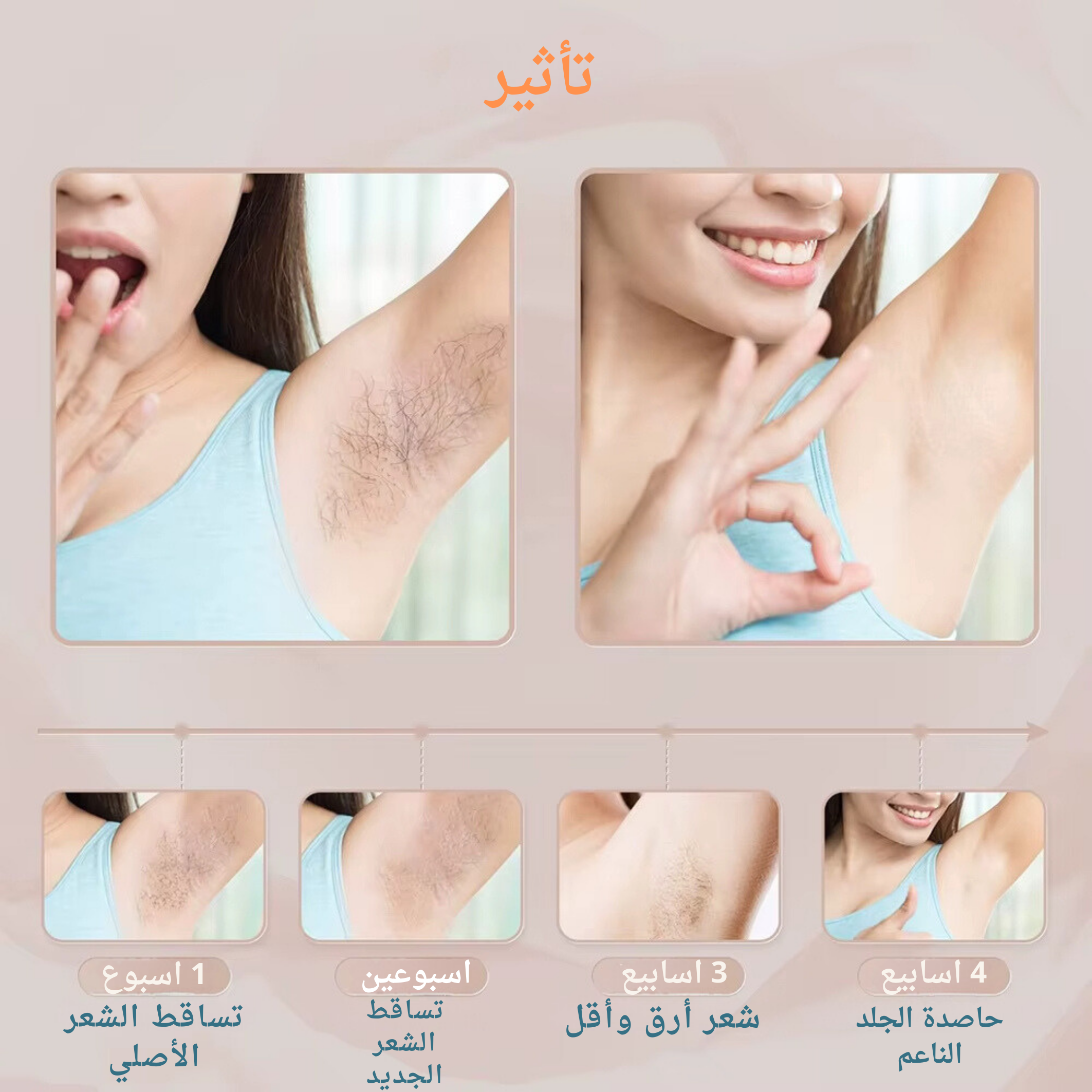 جهاز ازالة الشعر بالليزر