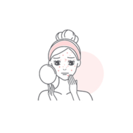 معالجة حب الشباب