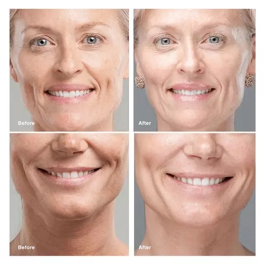 Collagen Face Serum Set - QAT _ سيروم لإزالة التجاعيد