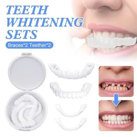 فينير الأسنان من  Snap-On Smile