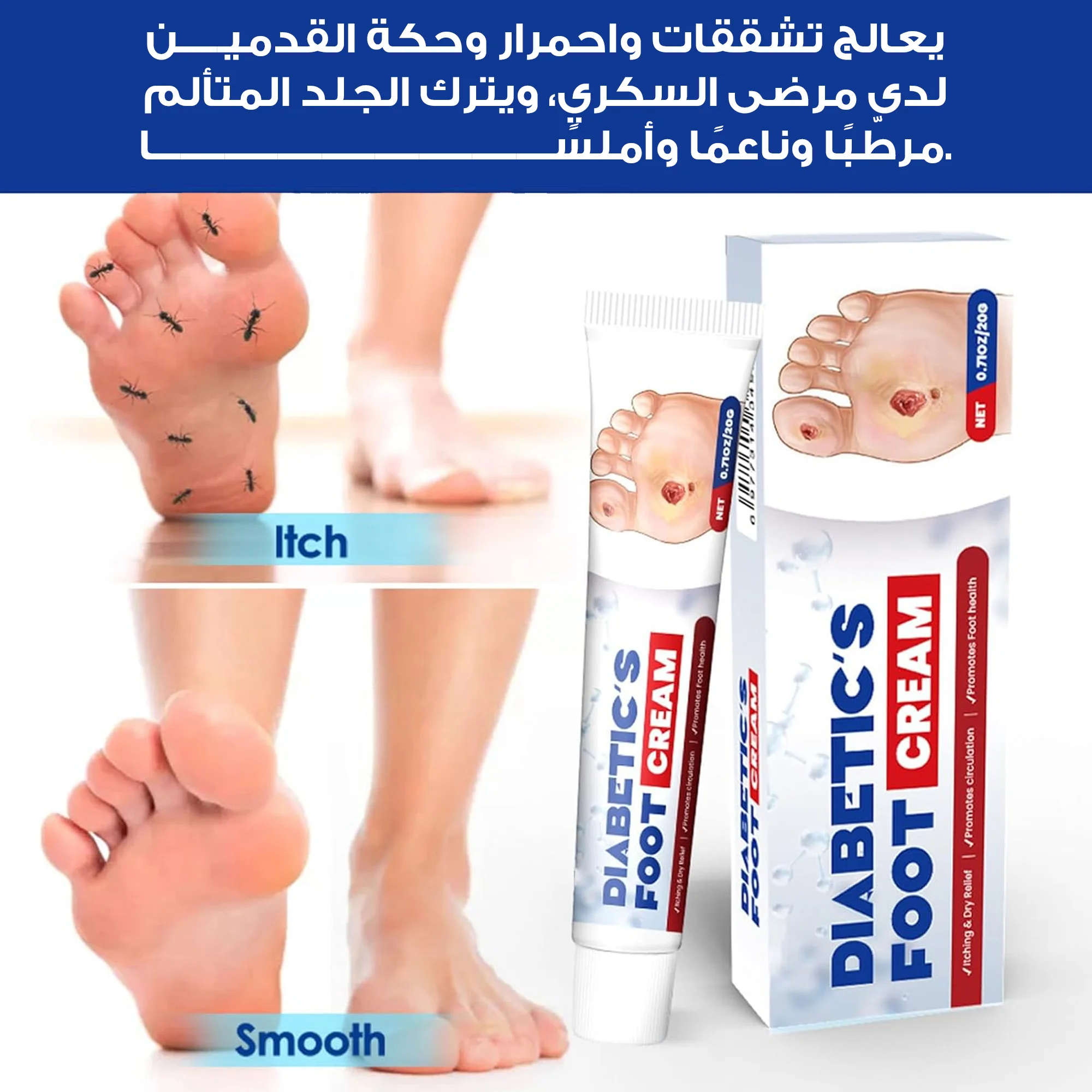 دهان فعال لعلاج قرح القدم السكري - 20 جرام
