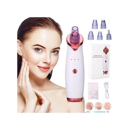 مزيل الرؤوس السوداء