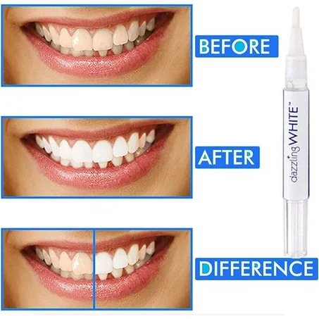 قلم تبيض الاسنان الاكثر طلباا