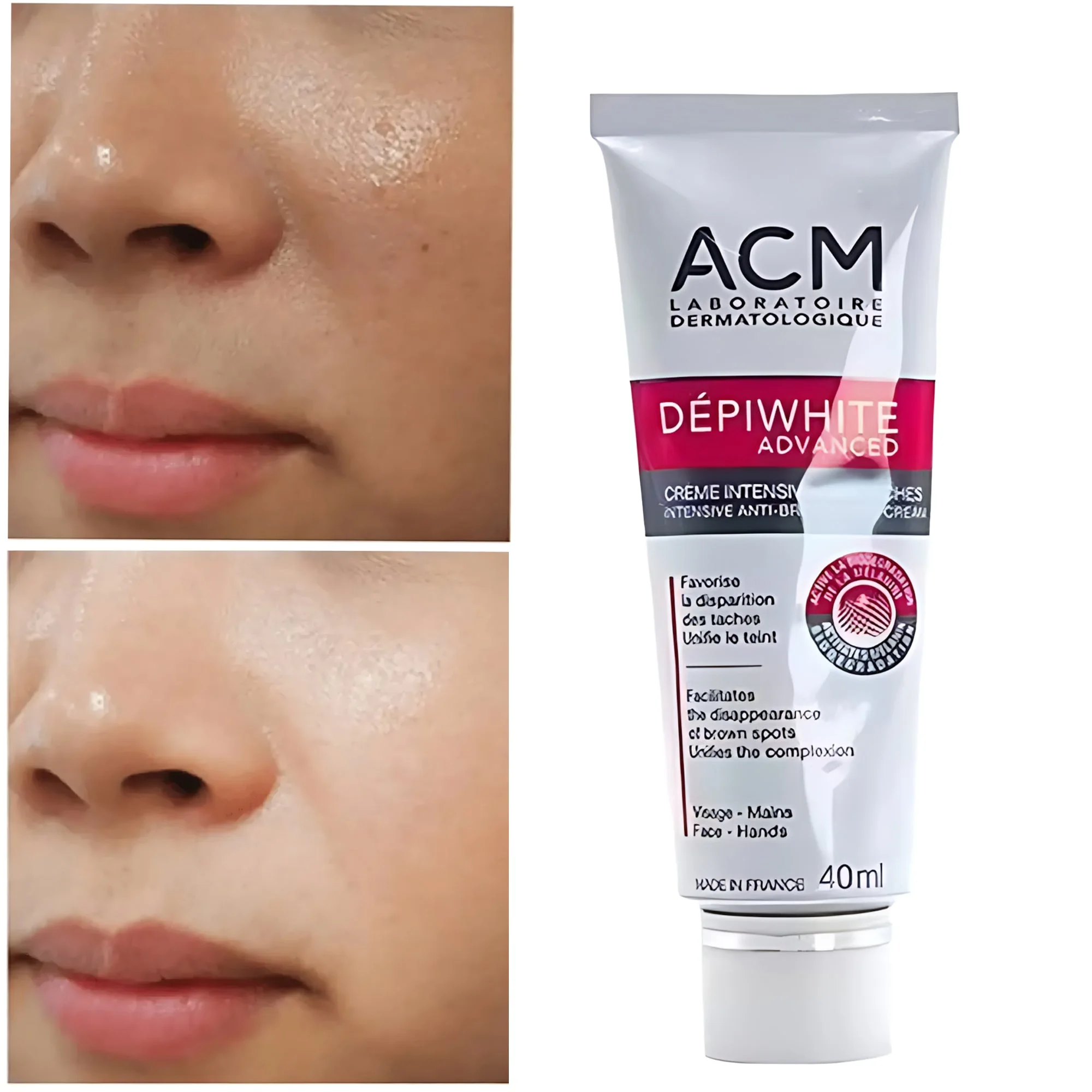ACM DEPIWHITE ADVANCED CREME DEPIGMENTANTE, 40ML