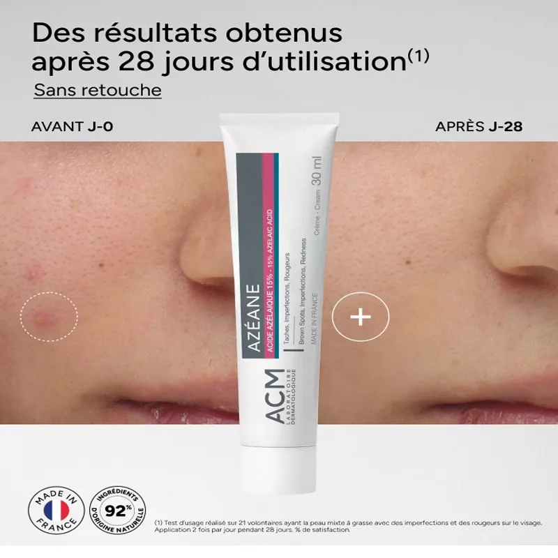 ACM Azéane – Crème à l'Acide Azélaïque 15% (30 ml)