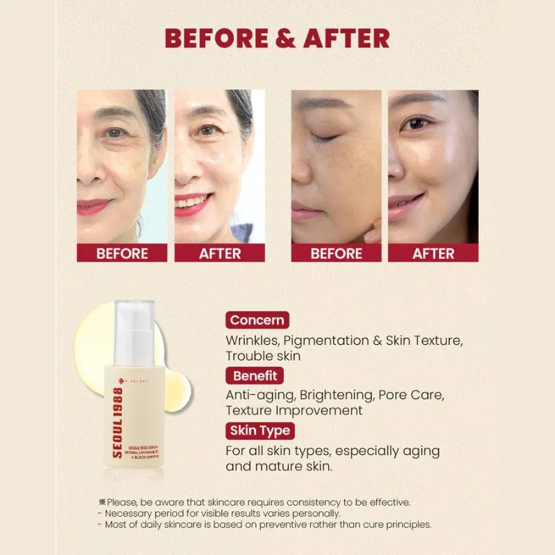 K-SECRET SEOUL 1988 – Sérum Rétinal Liposome 2% + Ginseng Noir (30ml)