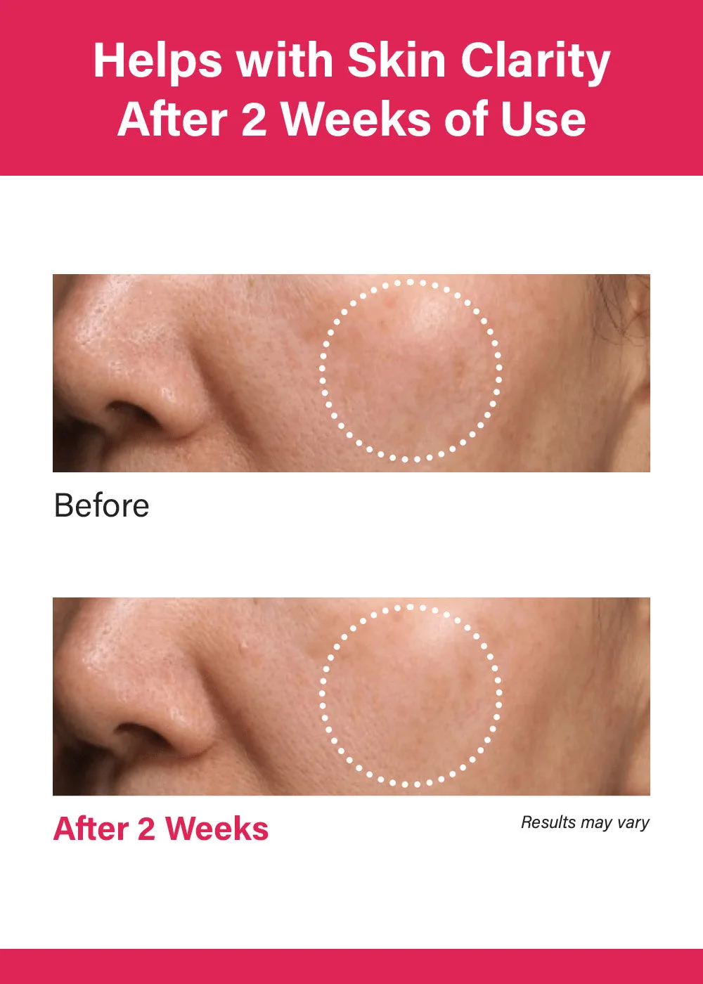 Anua Niacinamide 10% + TXA 4% Dark Spot Correcting Serum (30ml)