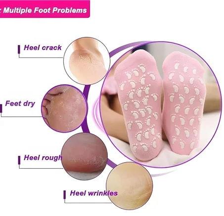 جوارب السيلكون للعناية من تشققشات القدم 🧦🦶👣