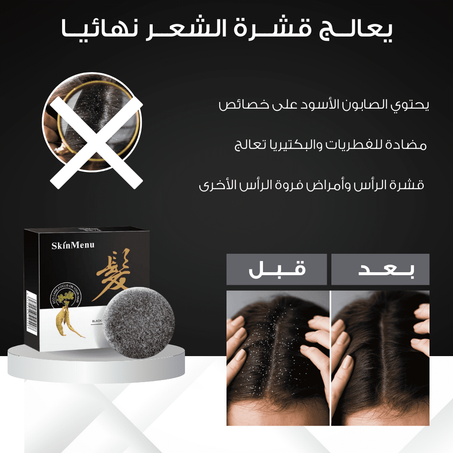 الصابون الأسود للعناية بالشعر والقشرة