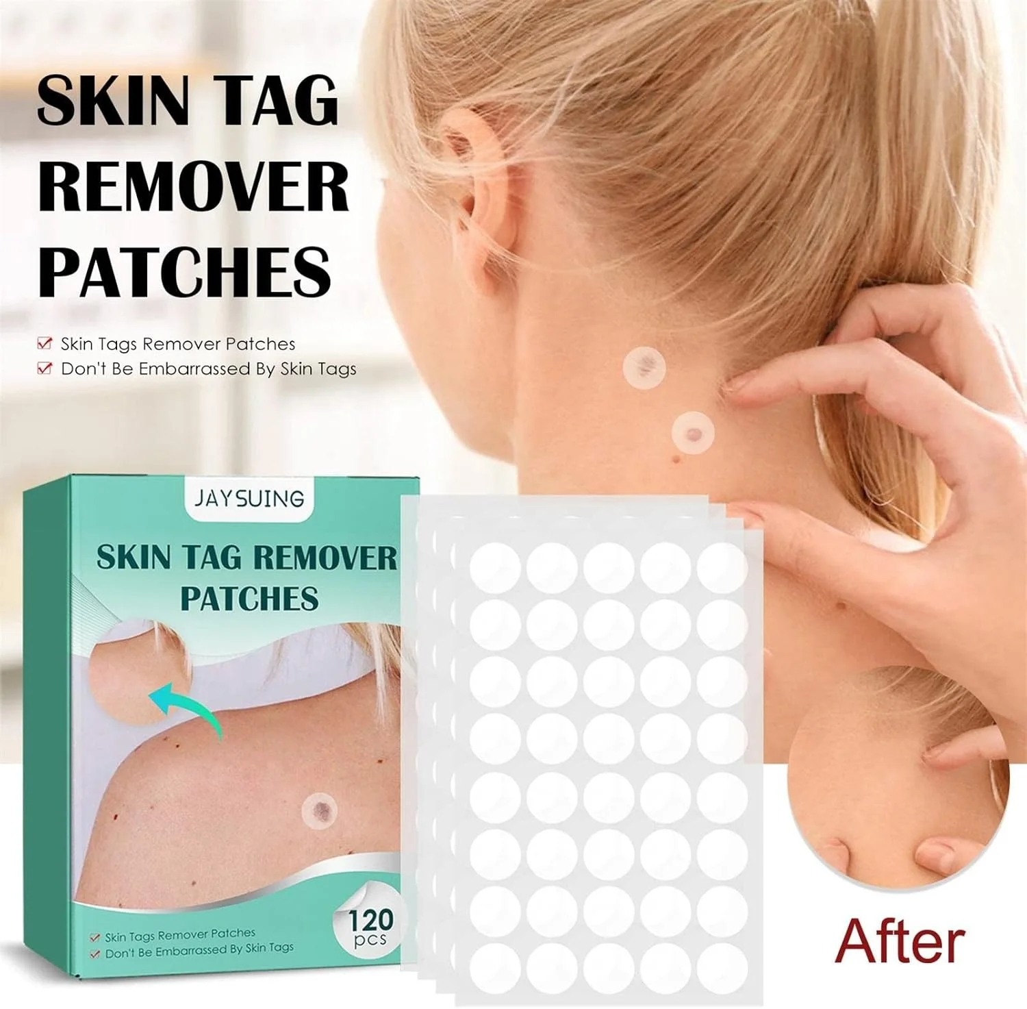 لاصقات لإزالة الزوائد الجلدية