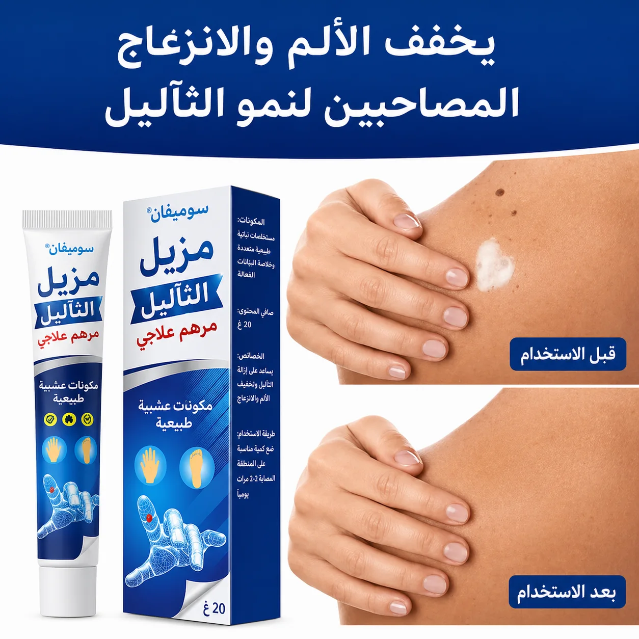 كريم إزالة الثآليل