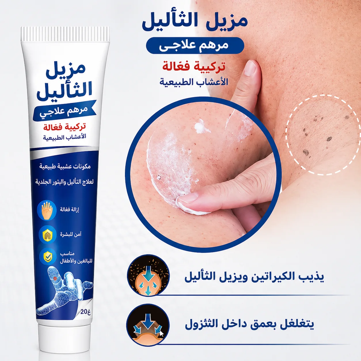 كريم إزالة الثآليل