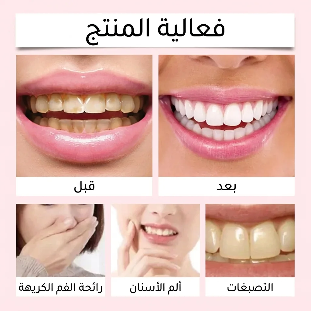 Oralhoe معجون تبييض الأسنان