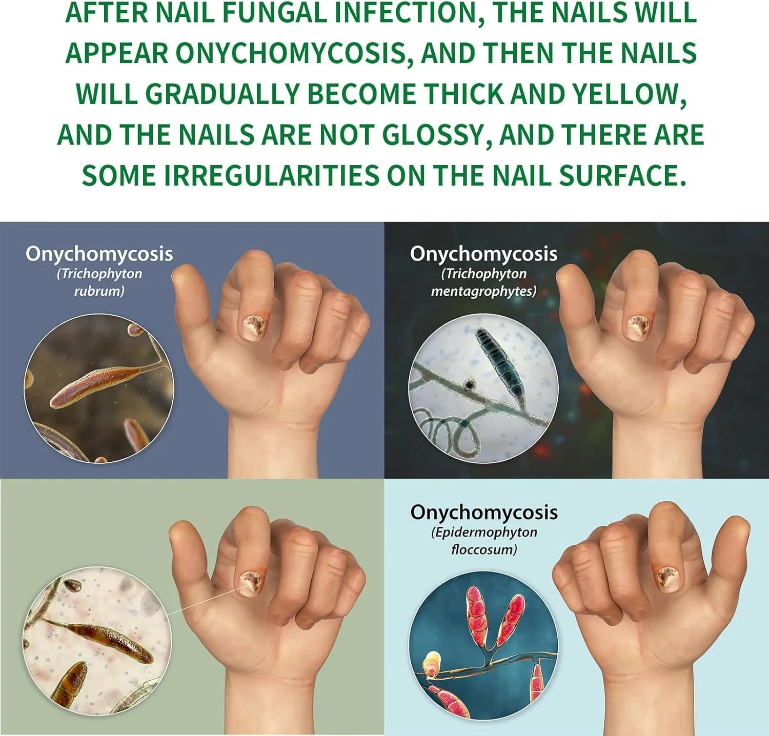 زيت العناية بالأظافر واليدين والرجلين