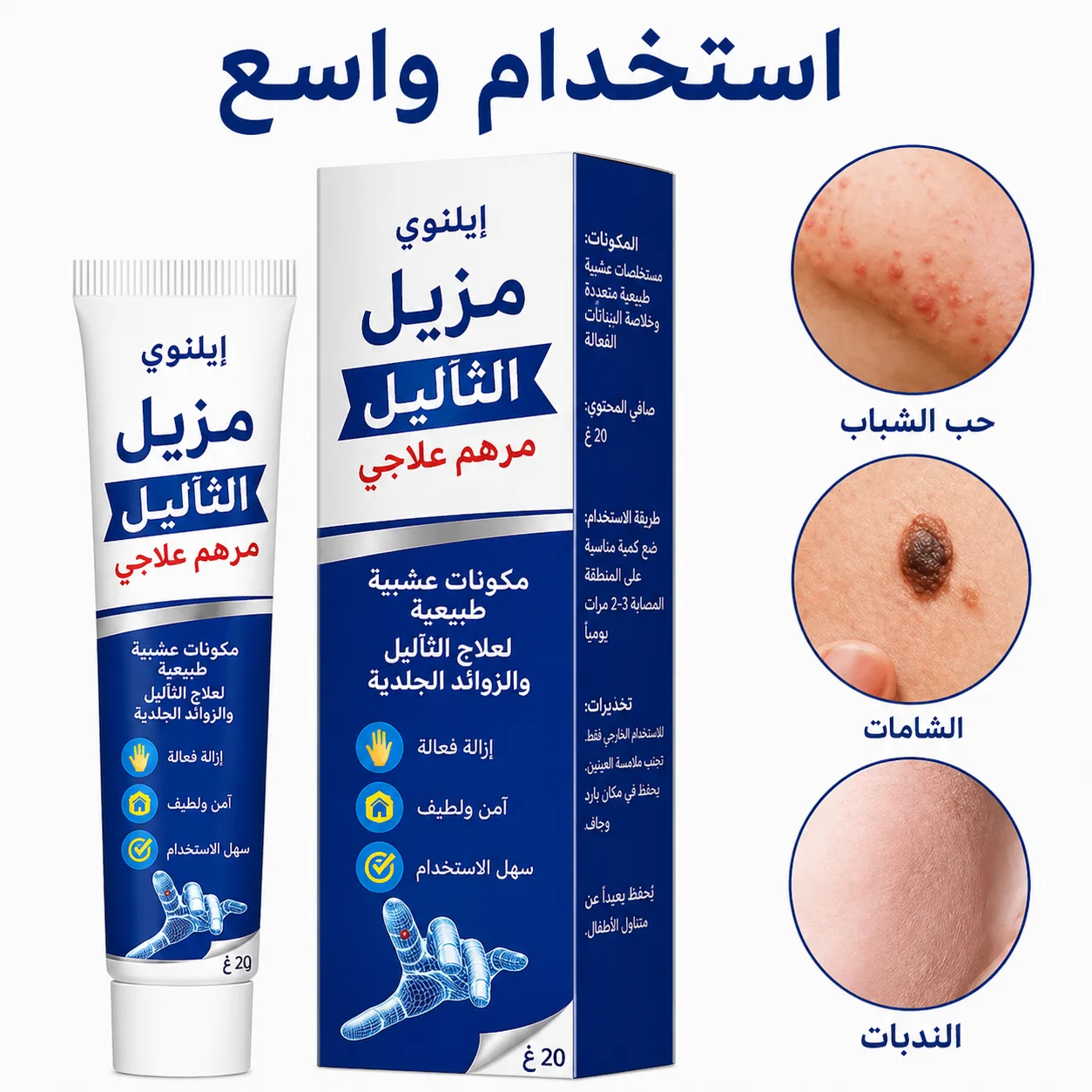كريم إزالة الثآليل