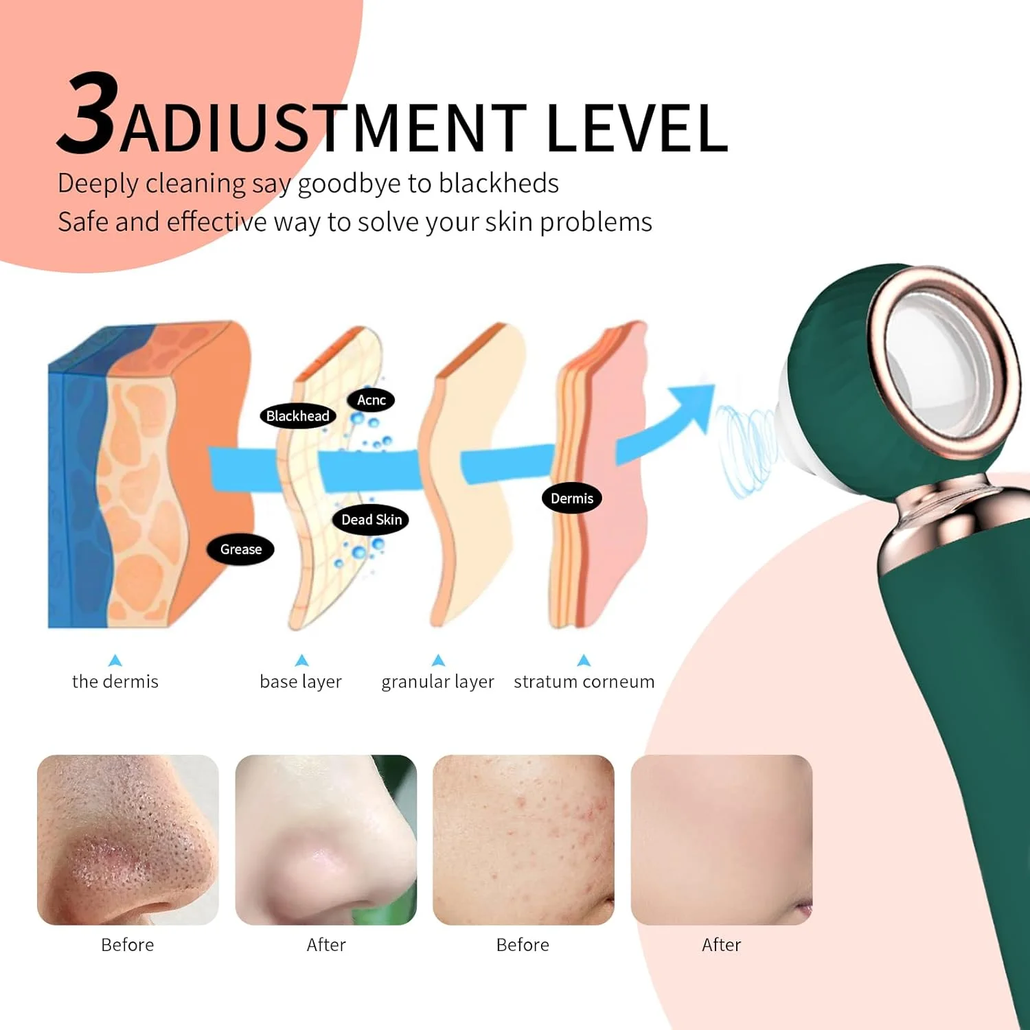 جهاز شفط الرؤوس السوداء الذكي