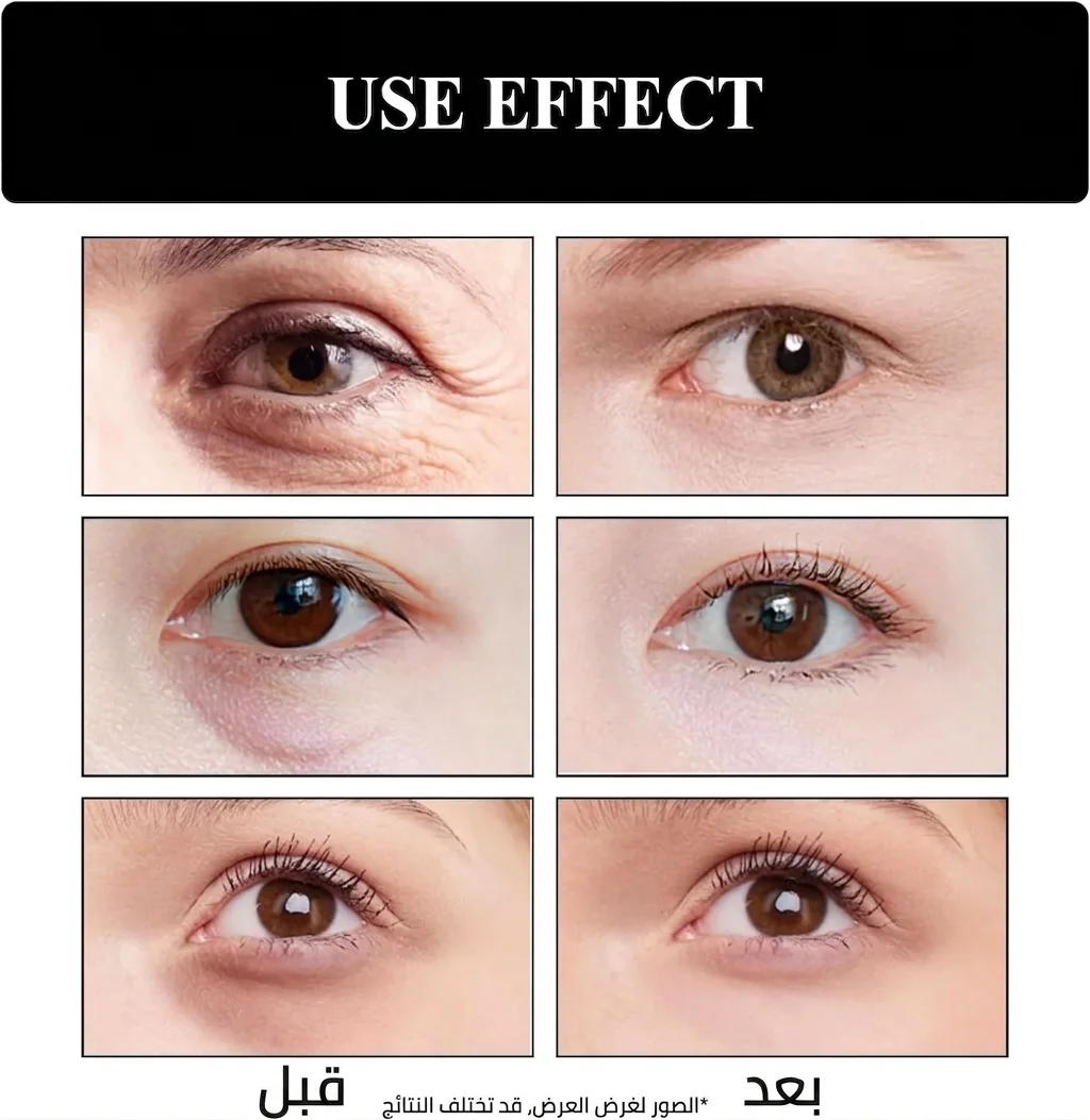 كريم العين بالريتينول وببتيدات سم الثعبان