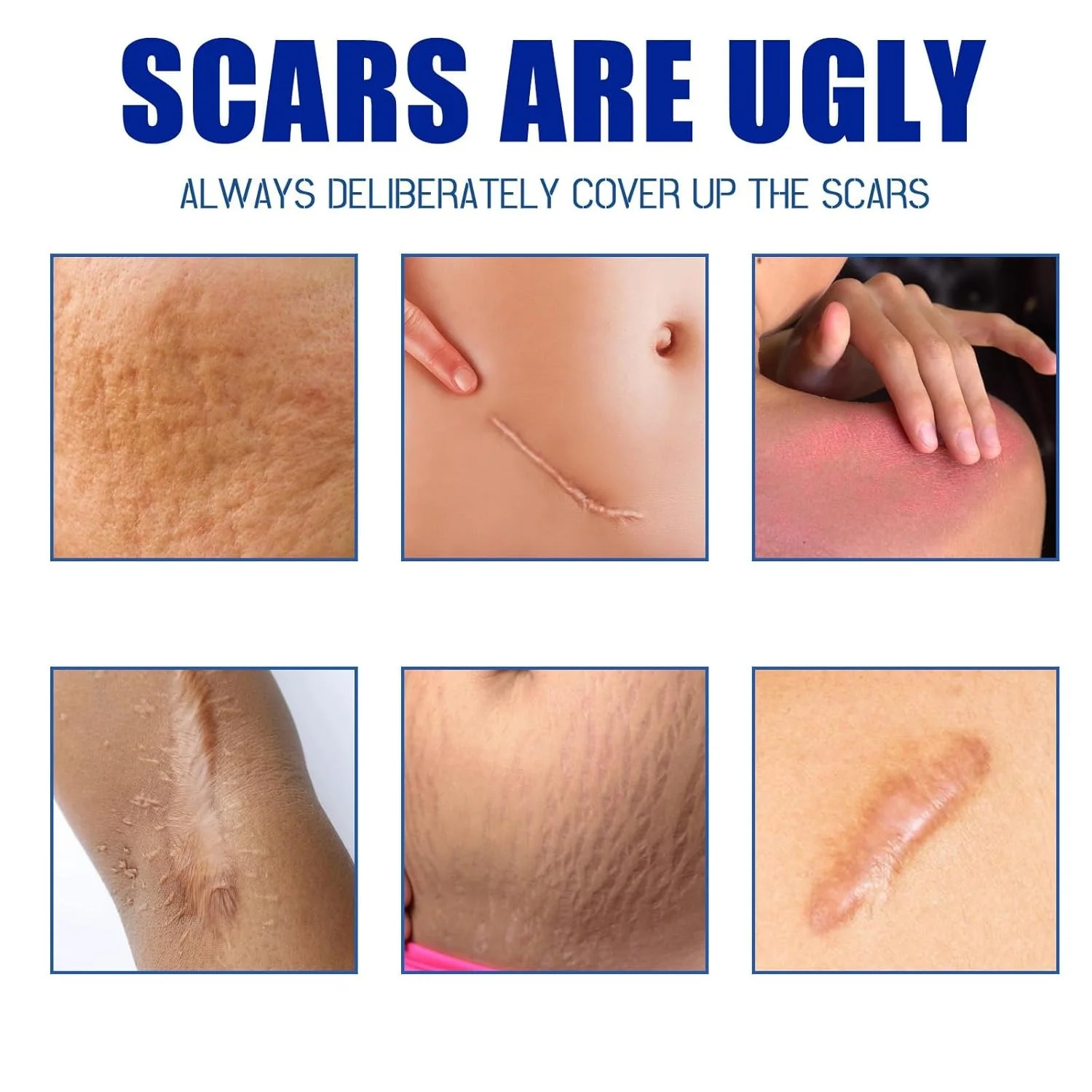 جل إزالة الندبات