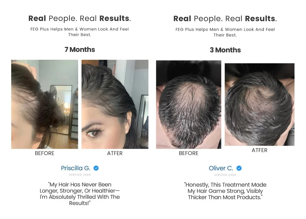 زيت تقوية الشعر FEG