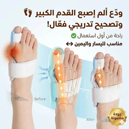 الحل النهائي لاعوجاج صبع القدم وراحة من الألم