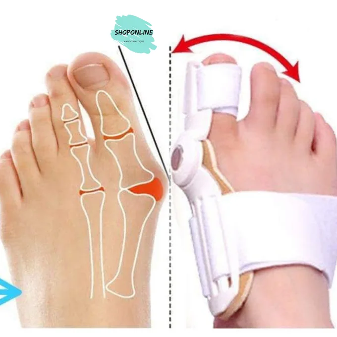 مصحح إعوجاج إصبع القدم