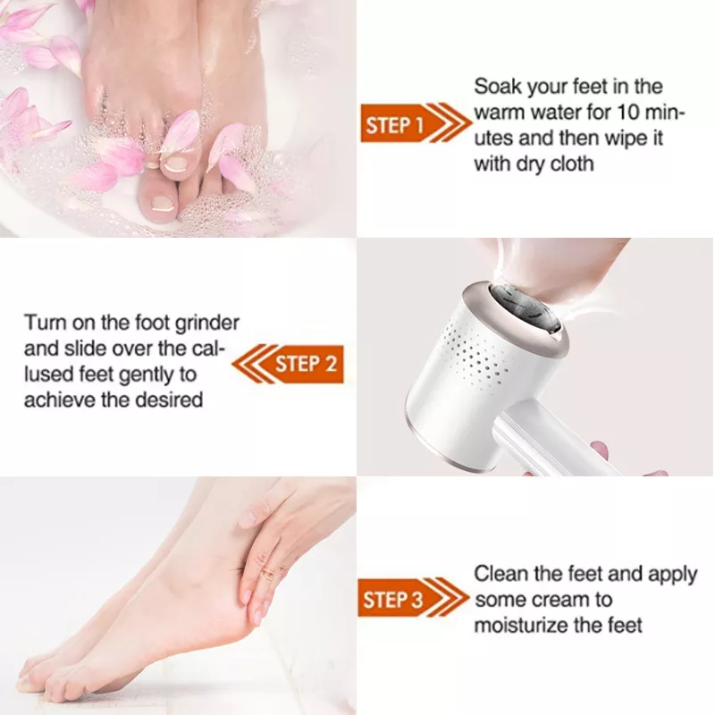 اداة لازالة الجلد المتصلب والميت من القدم شافط للقشور الاكثر مبيعا