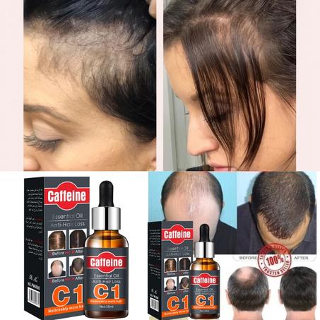 زيت الكافيين العطري لمكافحة تساقط الشعر الاكثر مبيعا في العالم!