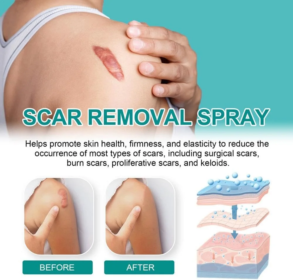 Spray Anti-Cicatrice -CIV