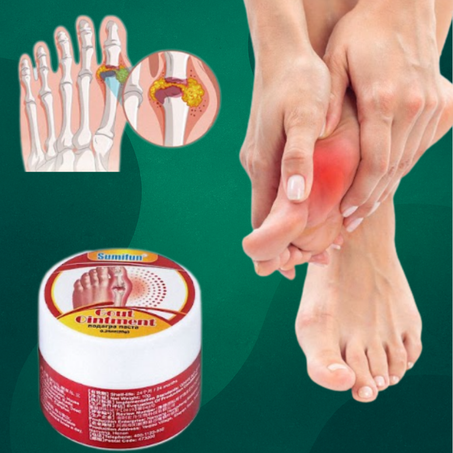 كريم علاج النقرس