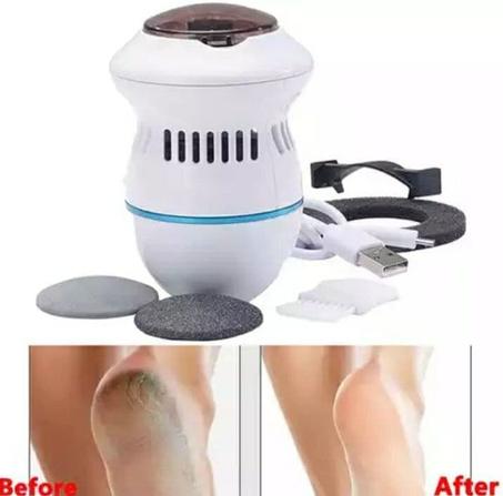 Pedi Vac جهاز لإزالة التشققات و الجلدالميت