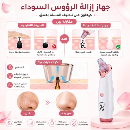 ✨ ودّعي الرؤوس السوداء وخلي بشرتك نقية وناعمة😍