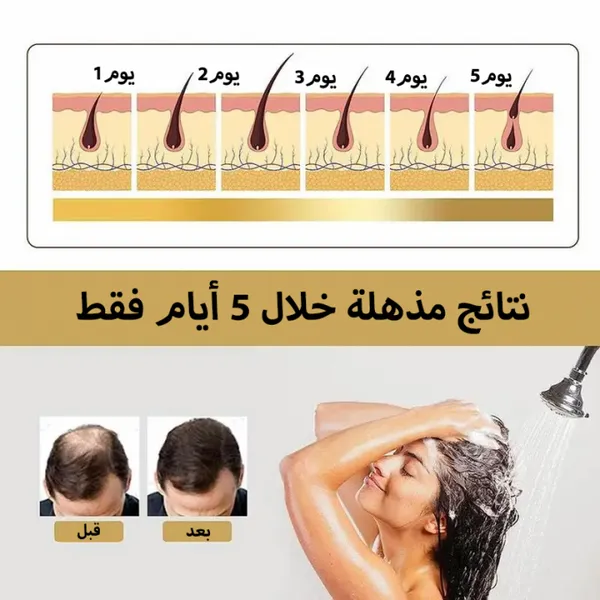 شامبو الياباني لاصلاح الشعر التالف