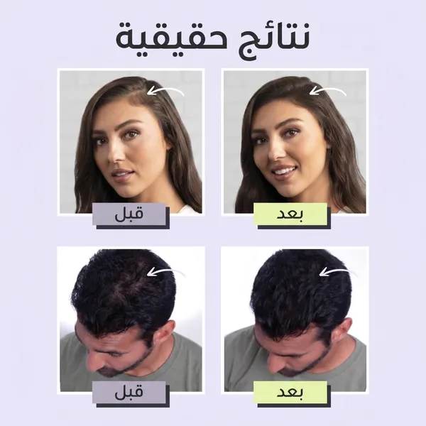 Toppik Hair Fibers لفراغات الشعر