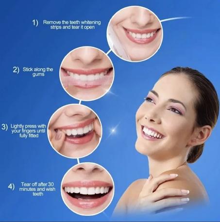 Teeth Whitening Gel - جل لتبييض الأسنان