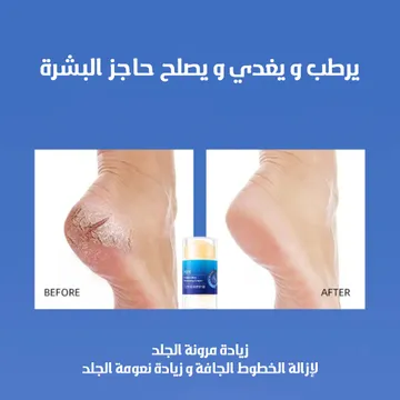 عرض 4 في 1 – دعامة كاحل + تدليك قدم + ستيك مرطب
