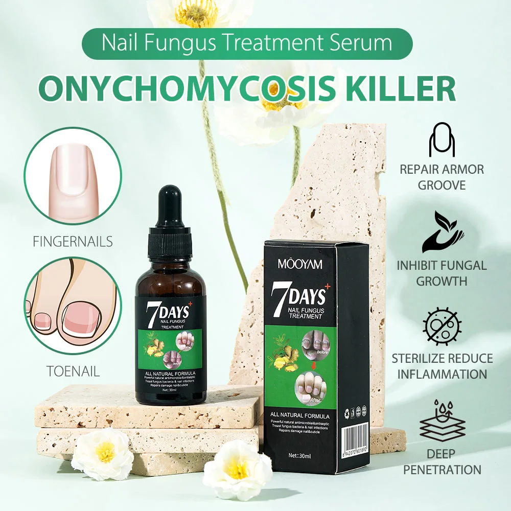 Sérum Anti-Champignons des Ongles – Traitement Intensif 7 Jours