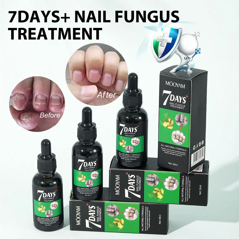 Sérum Anti-Champignons des Ongles – Traitement Intensif 7 Jours