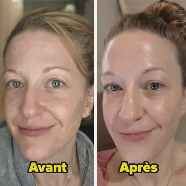 DR.MELAXIN Peel Shot Duo- Ampoule exfoliante au riz noir Shot