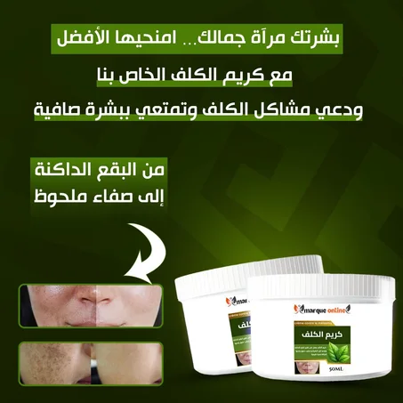 50ml كريم ضد الكلف Crème contre le mélasma